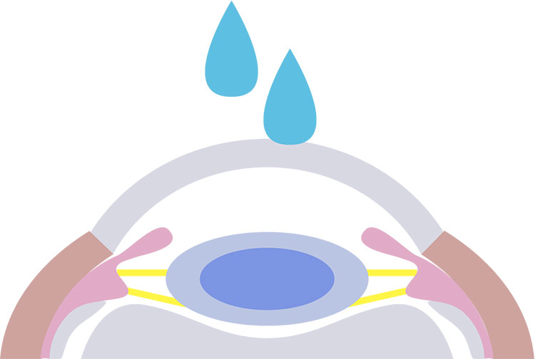 ➀点眼麻酔をします